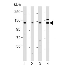 Anti-Vinculin