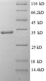 Interleukin-1 family member 10 (IL1F10), human, recombinant