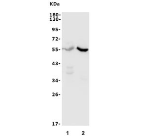 Anti-CYP11B1/2