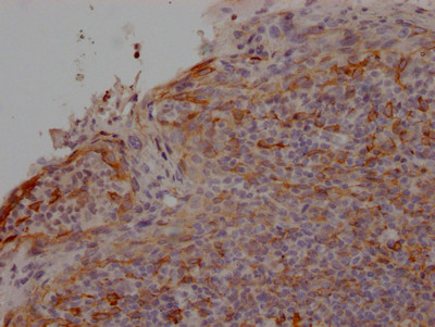 Anti-CCR2 Recombinant Monoclonal, clone 6A1