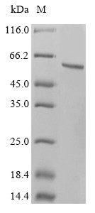 Tryptophan--tRNA ligase, cytoplasmic (WARS1), human, recombinant