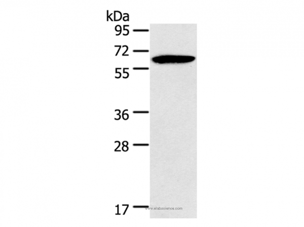 Anti-HMGCS2