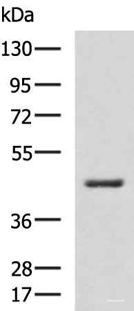 Anti-HSD3B2