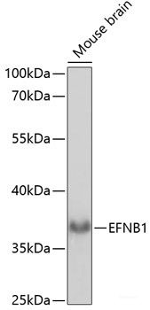 Anti-Ephrin B1