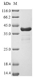 Fatty acid-binding protein 5 (FABP5), human, recombinant