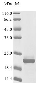 Glutamate receptor ionotropic, NMDA 1 (GRIN1),partial, human, recombinant