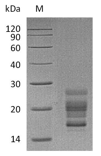 Interleukin-17A (Il17a), partial (Active), mouse, recombinant