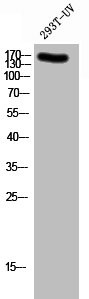 Anti-Phospho-GRIN2B (Y1336)