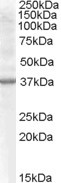 Anti-Renalase (aa 134 to 147), Internal