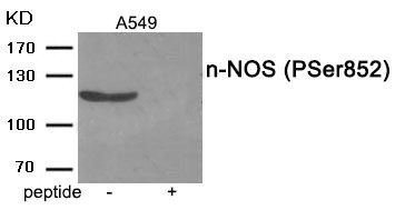Anti-Phospho-NOS1 (Ser852)