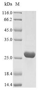 Insulin-like growth factor 1 receptor (IGF1R), partial, human, recombinant