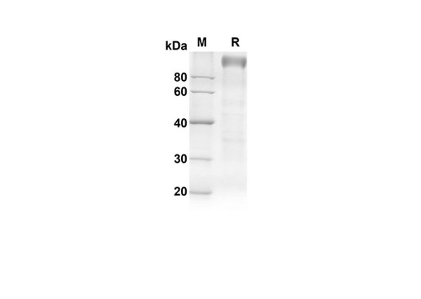 TLR4 Protein (Fc Tag) (recombinant rat)