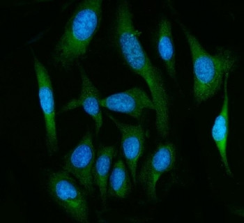 Anti-FAAH / Fatty-acid amide hydrolase 1