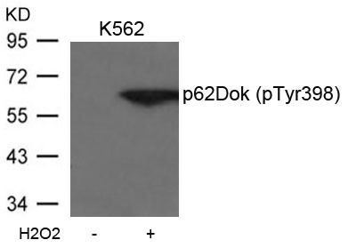 Anti-phospho-p62 Dok (Tyr398)