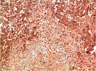 Anti-MAPK14 Monoclonal