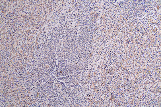 Anti-CD36 Recombinant Monoclonal, clone 13B12