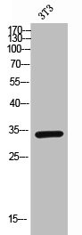 Anti-TNFRSF13B