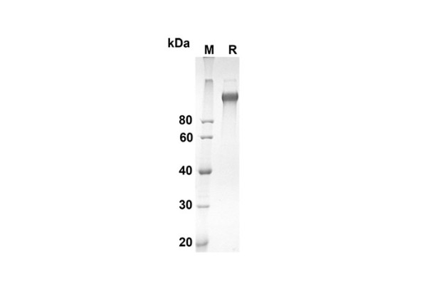 CD163 Protein (Fc Tag) (recombinant mouse)