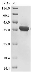 Deoxyribonuclease gamma (DNASE1L3), human, recombinant