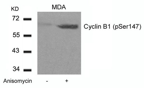 Anti-Phospho-CCNB1 (Ser147)