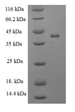 Acetylcholine receptor subunit alpha (Chrna1), partial, mouse, recombinant