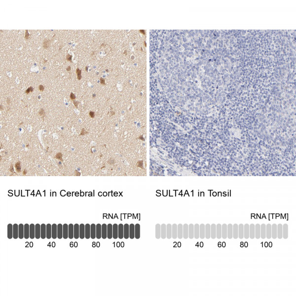 Anti-SULT4A1