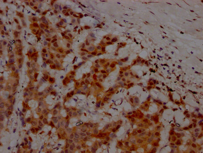 Anti-ATM Recombinant Monoclonal, clone 3G11