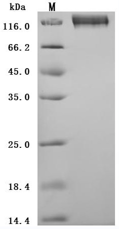 Carcinoembryonic antigen-related cell adhesion molecule 5 (CEACAM5) (E398K) (Active), human, recombi