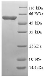 Cystathionine beta-synthase protein (CYS4), Saccharomyces cerevisiae, recombinant
