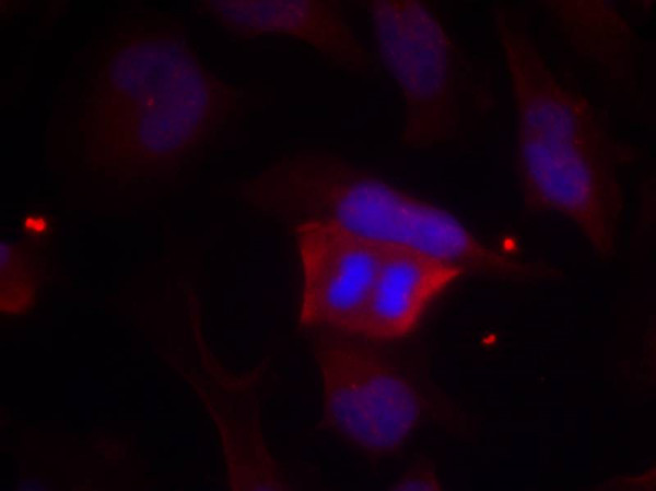 Anti-phospho-DARPP-32 (Thr75)