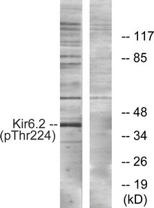 Anti-Phospho-KCNJ11 (Thr224)