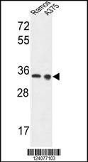 Anti-LDHA