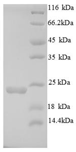 Integrin alpha-L (Itgal), partial, mouse, recombinant