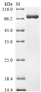 DNA topoisomerase 1 (TOP1), partial, human, recombinant