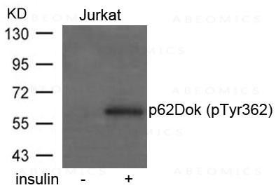 Anti-p62Dok (phospho-Tyr362)