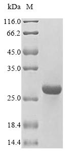 HLA class II histocompatibility antigen, DM beta chain (HLA-DMB),partial, human, recombinant