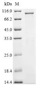 Cyclin-T1 (CCNT1), human, recombinant