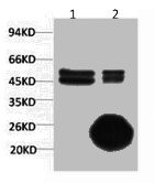 Anti-CA9 Monoclonal