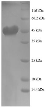 Transforming protein RhoA (RHOA), partial, human, recombinant