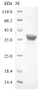 Poly [ADP-ribose] polymerase 2 (PARP2), partial, human, recombinant