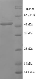 Proteasome subunit beta type-2 (PSMB2), human, recombinant