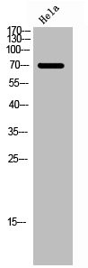 Anti-Phospho-FOXO1 (S256)