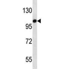 Anti-TLR7