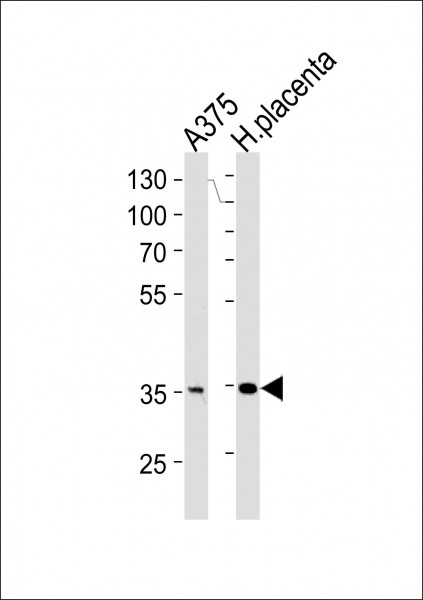 Anti-AKR1B1