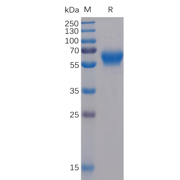 Human BTLA Protein, mFc-His Tag