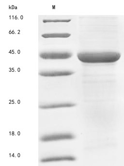 Acetyl-CoA acetyltransferase, mitochondrial (ACAT1), human, recombinant