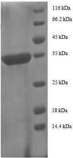 C-C motif chemokine 5 (CCL5), human, recombinant