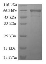 Fructose-bisphosphate aldolase A (ALDOA), human, recombinant