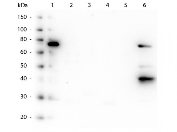 Anti-HUMAN IgM (Fc5µ), clone 22G1.H8