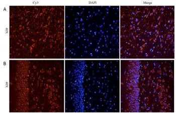 Anti-CHRNA7